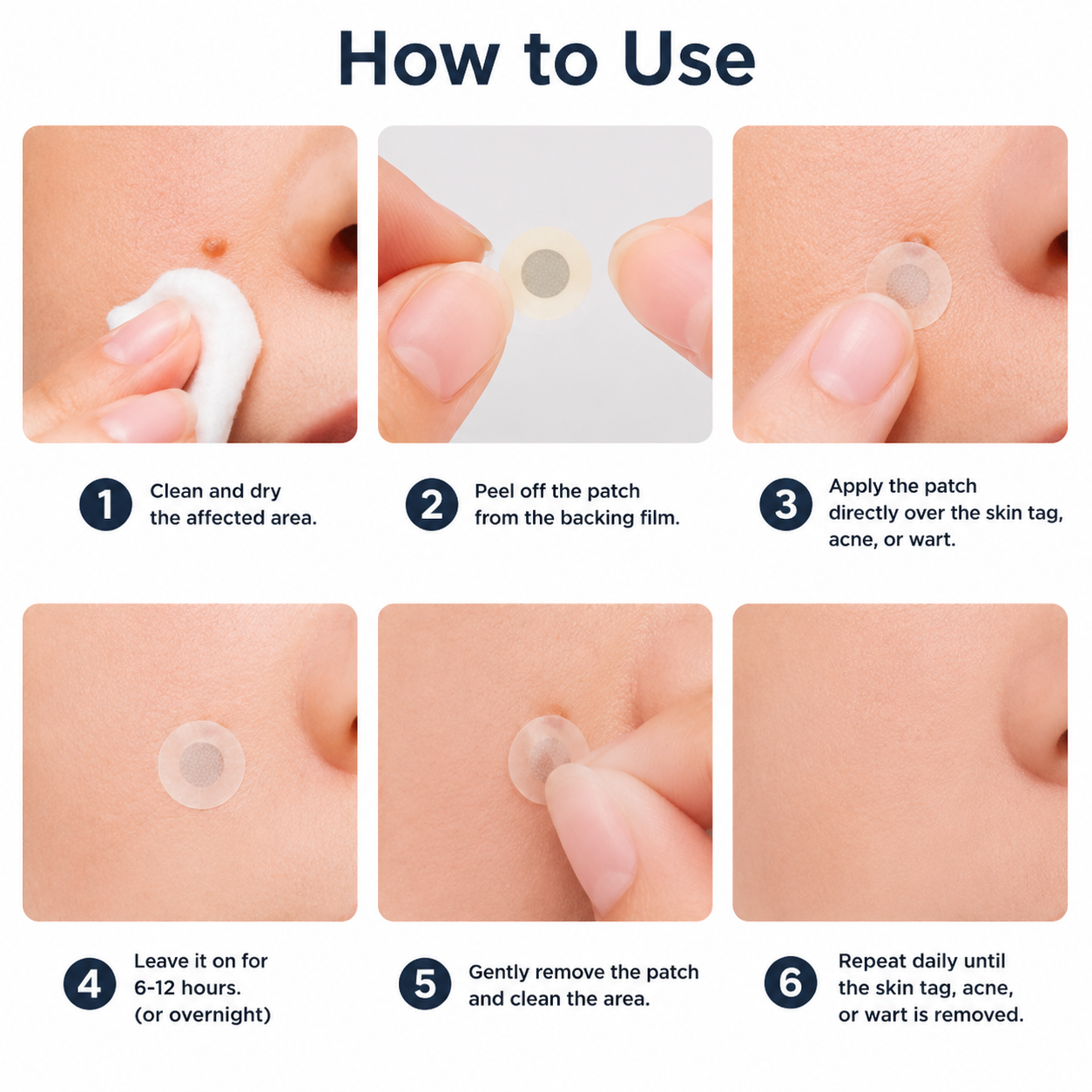 Markedhe 2-in-1 Microneedle & Hydrocolloid Patch🍀| Removes Raised Moles, Acne, Flat Warts & Skin Tags | Helps Improve Wrinkles, Scars & Blemishes | Invisible Patches for Face & Body