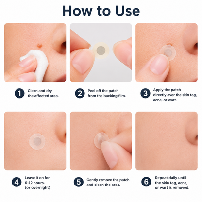 Markedhe 2-in-1 Microneedle & Hydrocolloid Patch🍀| Removes Raised Moles, Acne, Flat Warts & Skin Tags | Helps Improve Wrinkles, Scars & Blemishes | Invisible Patches for Face & Body