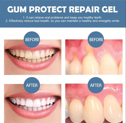 📢📢50% Off!!⏰ Teeth Whitening & Repair Gel 🦷