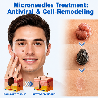 Markedhe 2-in-1 Microneedle & Hydrocolloid Patch🍀| Removes Raised Moles, Acne, Flat Warts & Skin Tags | Helps Improve Wrinkles, Scars & Blemishes | Invisible Patches for Face & Body