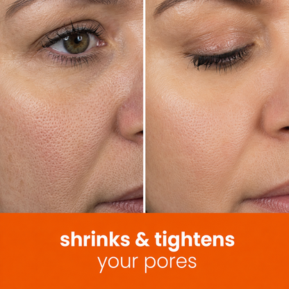 🔥Last Day 68% OFF-Markedhe Turmeric Kojic Glow Pads
