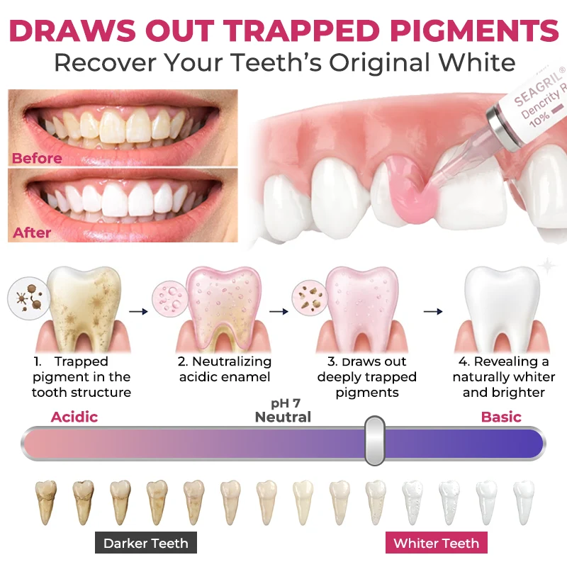 Cavity-Repair Natural Enamel Filling Gel